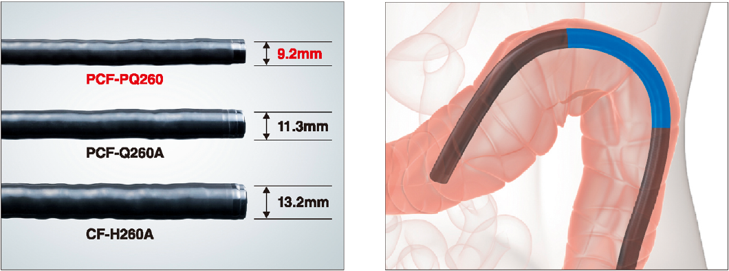 受動湾曲細径大腸内視鏡